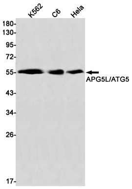 IF - APG5L Rabbit mAb AP75090
